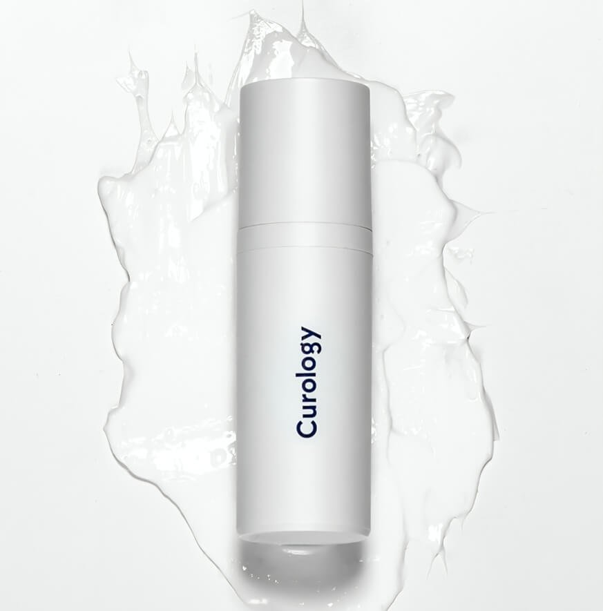 E-commerce AP optimization case study